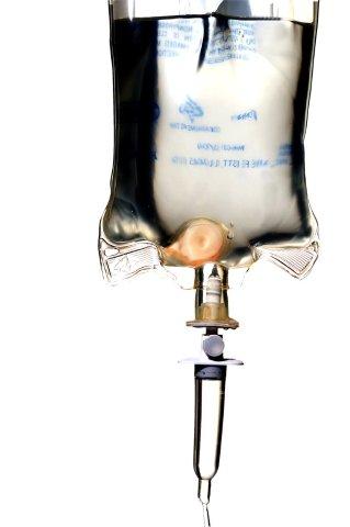 IV Solution Bag, Source: CanStock IV Solution Bag, Source: CanStock