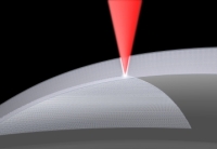 The laser-microkeratome by Rowiak cuts the cornea with OCT-control shortly above the endothelium.