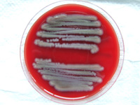 Dangerous Bacteria like Salmonella can be detected within seconds