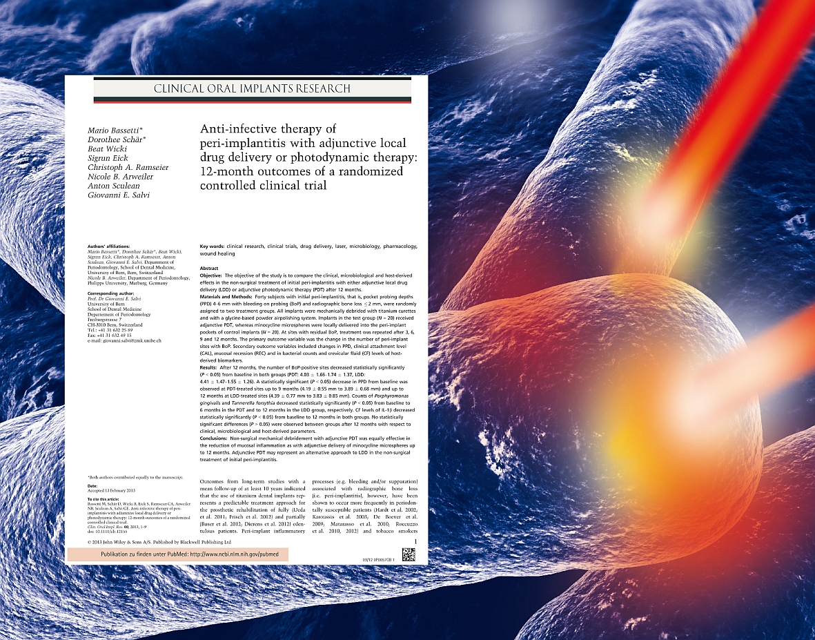 Successful treatment of peri-implantitis with HELBO treatment: the one-year data in comparison with Successful treatment of peri-implantitis with HELBO treatment: the one-year data in comparison with