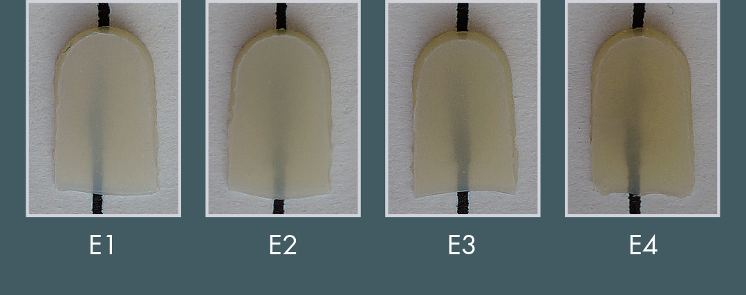 crea.lign freestyle - veneering system in freestyle layering