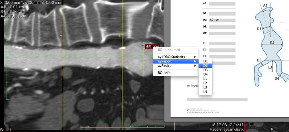 New version of the PACS viewer aycan OsiriX PRO available
