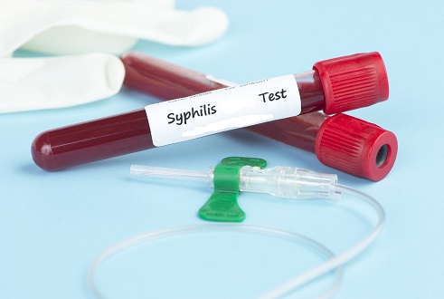 syphilis testing market syphilis testing market