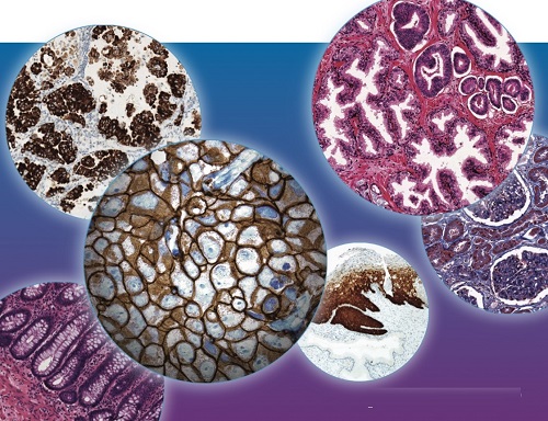 tissue diagnostics market