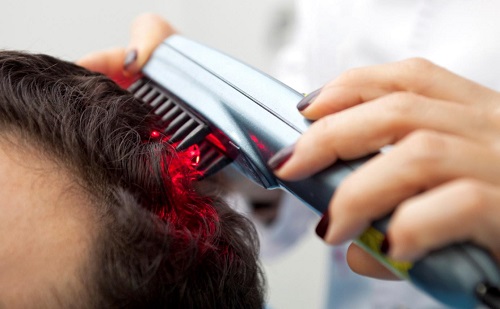 laser hair loss treatment market