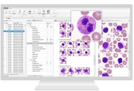 automated blood cell counter market