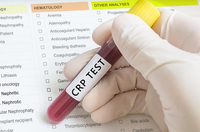 C-Reactive Protein (CRP) Test Market C-Reactive Protein (CRP) Test Market