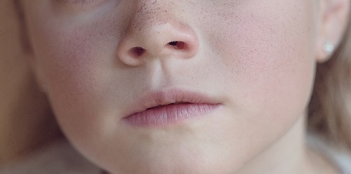 Freckle Cosmetics Market Freckle Cosmetics Market