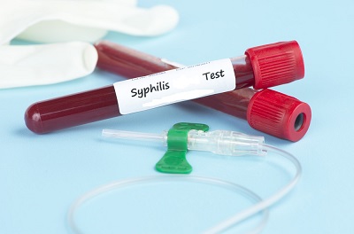Syphilis Testing Industry