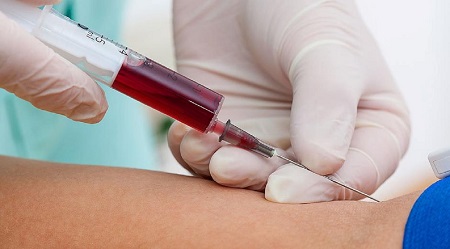 Blood Collection Market