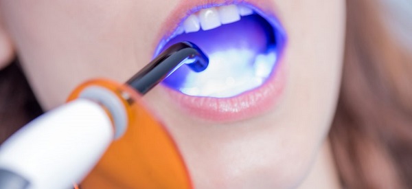 Dental Curing Light Industry Dental Curing Light Industry