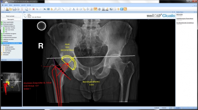 New version 2.50 of the