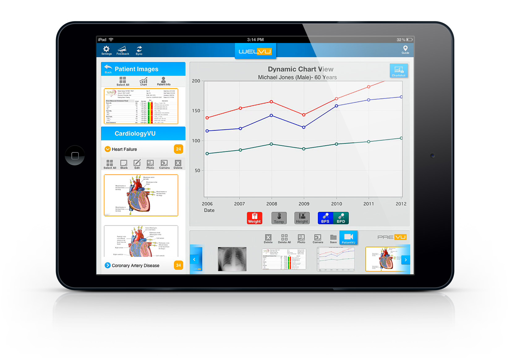 iPad Frame_cardio_pt chart1 iPad Frame_cardio_pt chart1