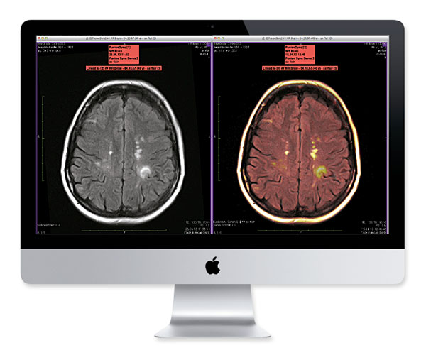 Professionelle Bildverarbeitung mit der aycan OsiriX PRO Onkologie-Workstation.