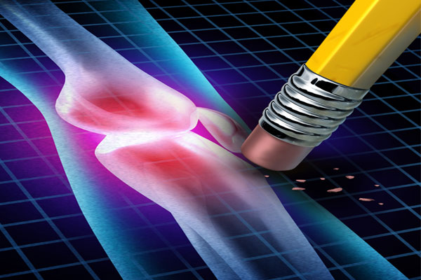 Radieren sie die aktivierte Arthrose aus, und erlangen wieder mehr Lebensqualität. Radieren sie die aktivierte Arthrose aus, und erlangen wieder mehr Lebensqualität.