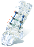 Hybridinstrumentierung mit tangoRS und cosmicMIA
