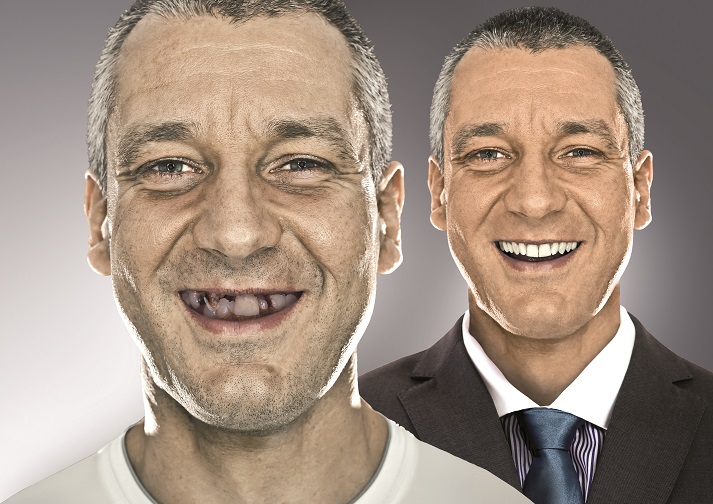 Sorgenlos mit nur einem Eingriff?die SKY fast&fixed Therapie