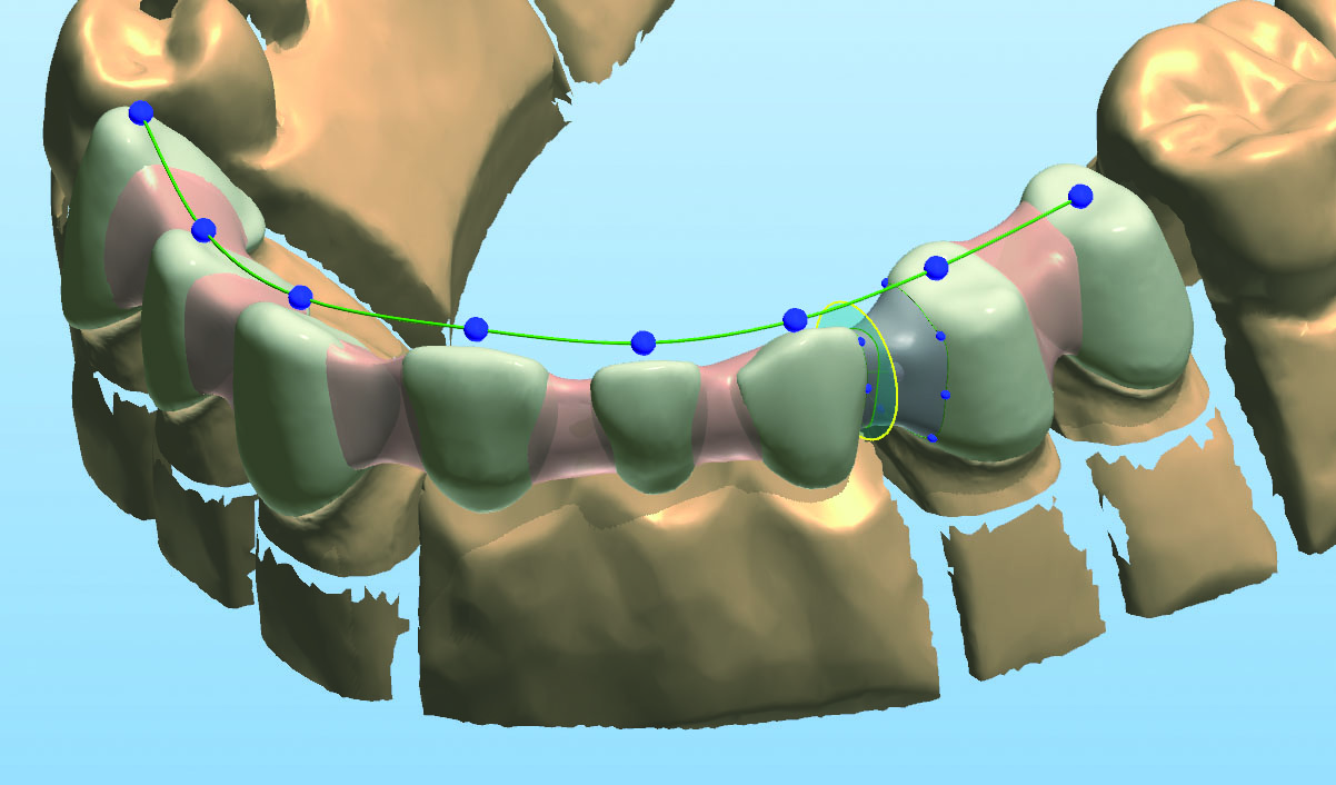 Günstiger Zahnersatz aus dem deutschem Dentallabor Maxident: Best-Price-Dent rät zum Kostenvergleich Günstiger Zahnersatz aus dem deutschem Dentallabor Maxident: Best-Price-Dent rät zum Kostenvergleich