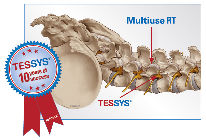 Multiuse RT: Facettengelenksdenervierung, TESSYS®: Intrakanale Zugangstechnik