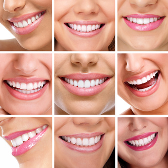 Veneers für ein schöneres Lächeln Veneers für ein schöneres Lächeln