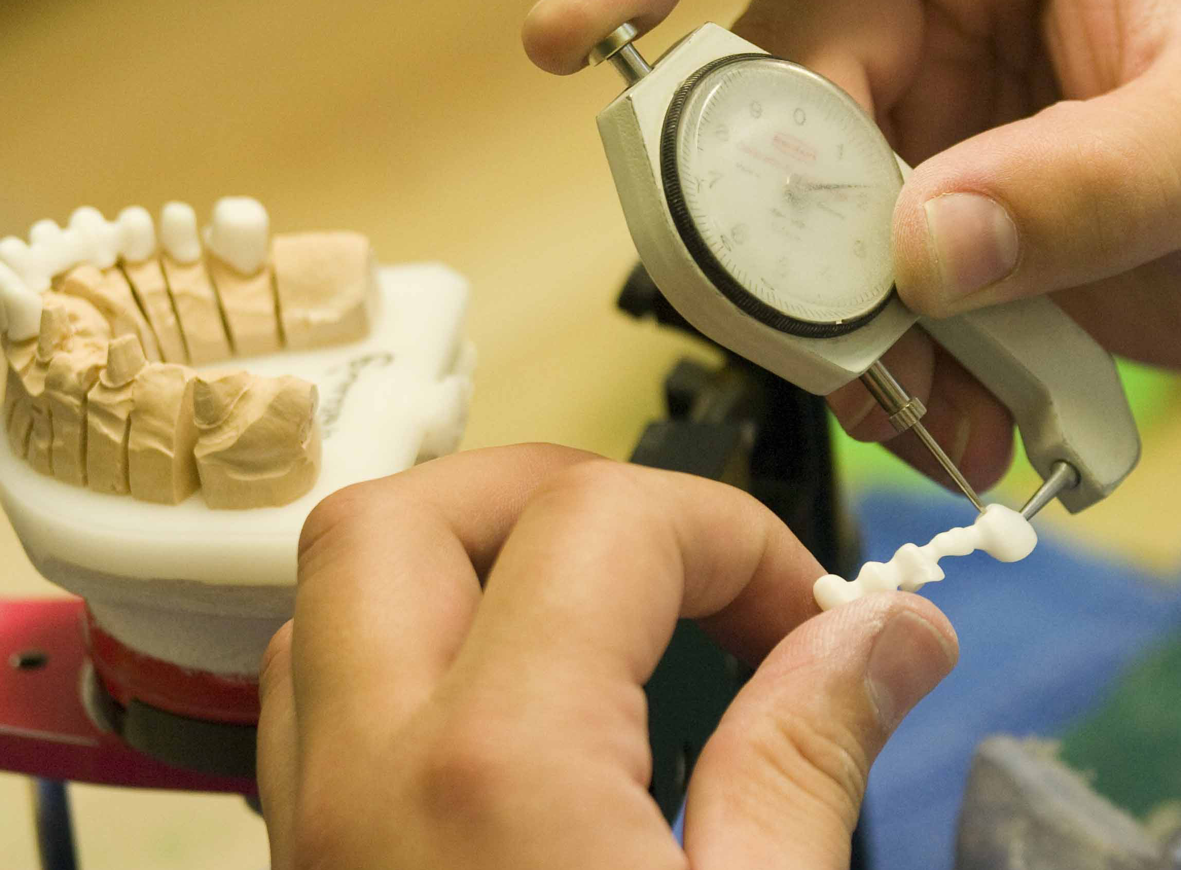 Günstiger Zahnersatz aus deutschem Dentallabor durch modernste Technik: Best-Price-Dent rät zum Zahn Günstiger Zahnersatz aus deutschem Dentallabor durch modernste Technik: Best-Price-Dent rät zum Zahn