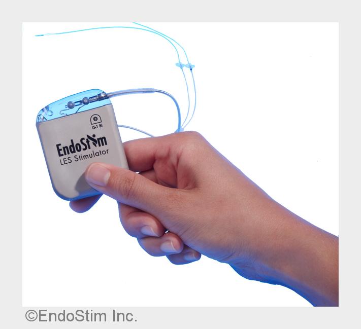 EndoStim - kleiner Schrittmacher, große Wirkung (Bildquelle: EndoStim Inc.)