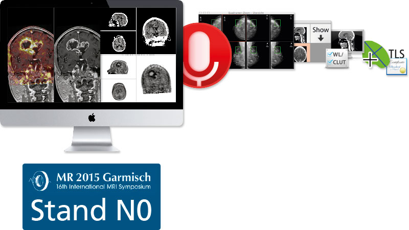 Besuchen Sie uns in Garmisch-Partenkirchen und entdecken Sie die neue Version von aycan OsiriX PRO.