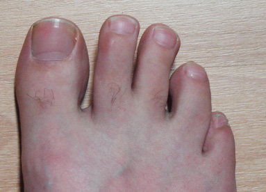 Füße brauchen Pflege (Foto: nagelwohl.de)