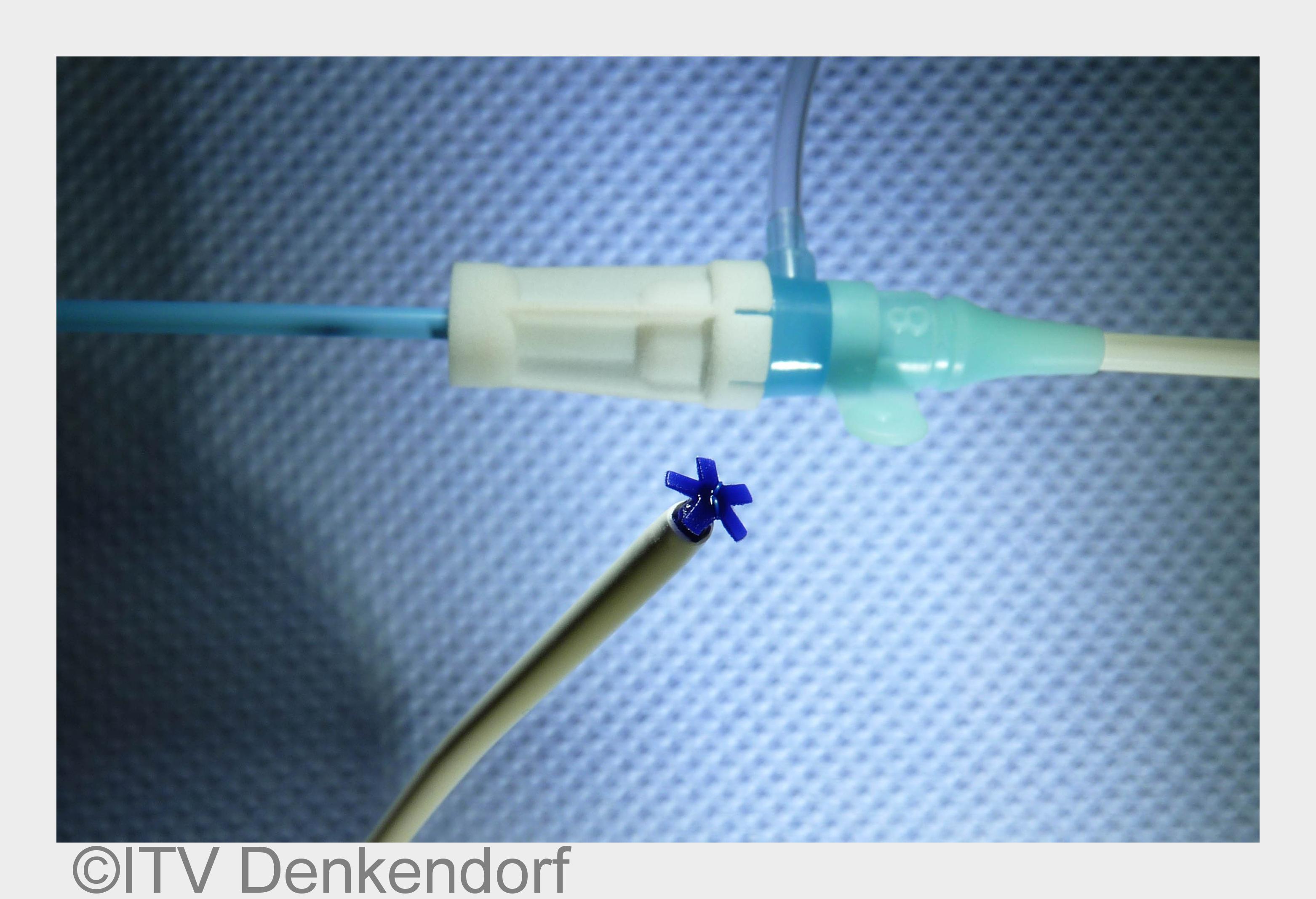 Resorbierbarer Gefäßschnellverschluss nach arterieller Punktion mit einem gängigen Schleusensystem (