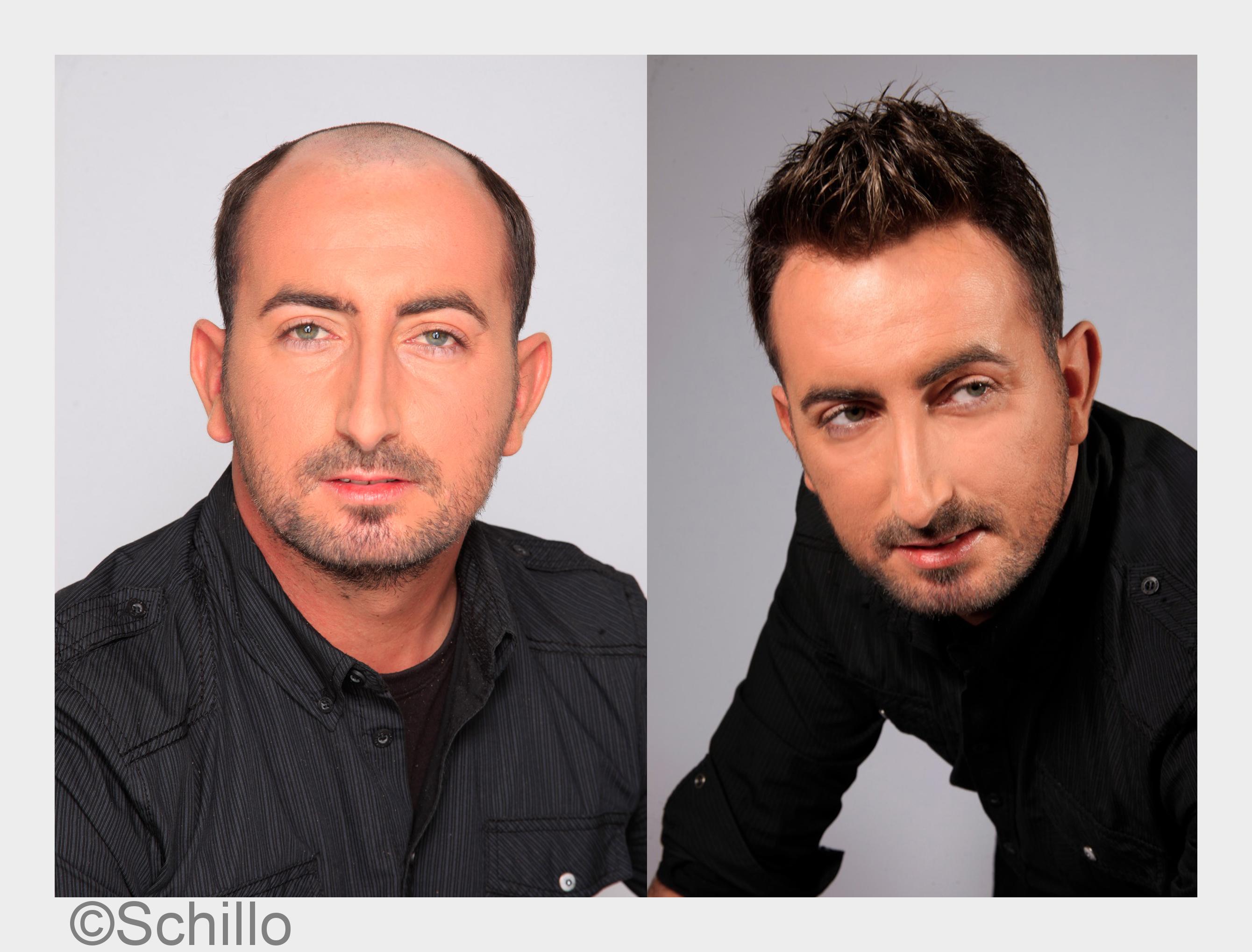?vorher / nachher?(Bildquelle: Schillo)