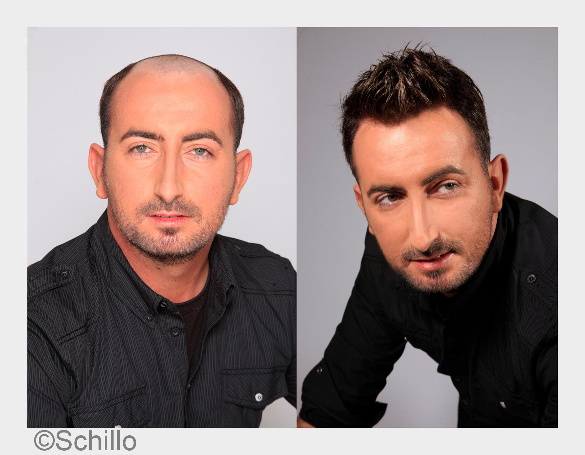 vorher / nachher (Bildquelle: Schillo)