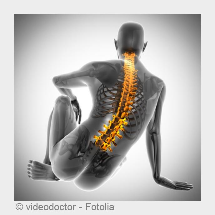 Wird die Osteoporose nach einem Knochenbruch festgestellt, ist die Krankheit oft fortgeschritten. (B