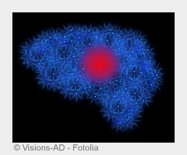 Moderne Diagnoseverfahren am Klinikum in Siegen helfen bei einem Hirntumor. (Bildquelle:©Visions-AD Moderne Diagnoseverfahren am Klinikum in Siegen helfen bei einem Hirntumor. (Bildquelle:©Visions-AD