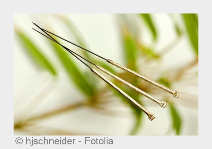 Die Traditionelle Chinesische Medizin (TCM) mit ihrer bekannteste Behandlungsmethode der Akupunktur.
