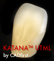Frontzahnkrone KATANA(TM) UTML by CADfirst Frontzahnkrone KATANA(TM) UTML by CADfirst