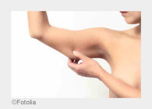 Oberarme professionell behandeln lassen (Bildquelle: Fotolia)