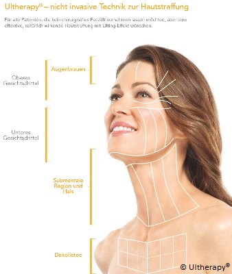 Dr. Prager & Partner: Ultraschallwellen straffen die Haut  - ©Ultherapy®
