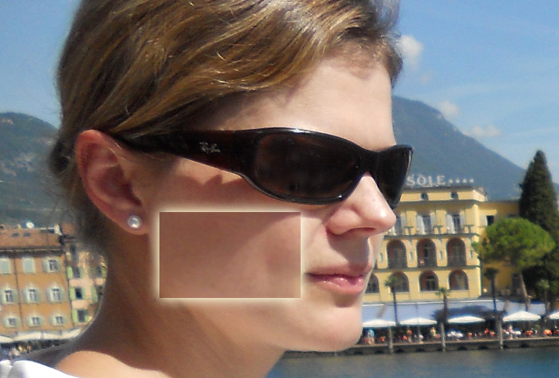 Ein jugendliches Bild der Haut ohne Pigmentflecken