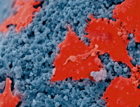 Falschfarbendarstellung eines mit Osteoblasten besiedelten ossceram nano Partikels Falschfarbendarstellung eines mit Osteoblasten besiedelten ossceram nano Partikels