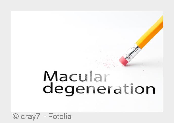 Früherkennung bei einer Makuladegeneration ist wichtig. (Bildquelle:©cray7 - Fotolia) Früherkennung bei einer Makuladegeneration ist wichtig. (Bildquelle:©cray7 - Fotolia)