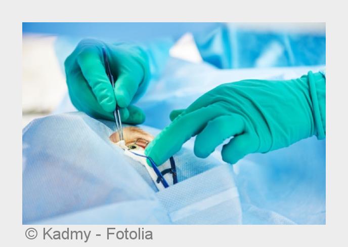 Gegen den Grauen Star hilft nur eine Operation. (Bildquelle:©Kadmy - Fotolia) Gegen den Grauen Star hilft nur eine Operation. (Bildquelle:©Kadmy - Fotolia)