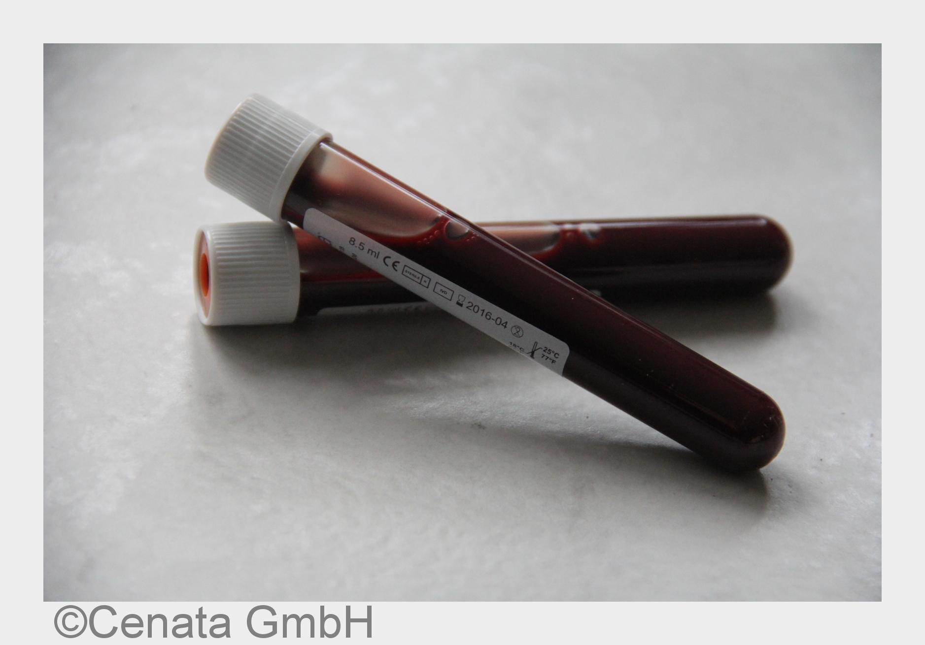Blutanalyse der Mutter für eine pränatale Untersuchung ohne Risiko (Bildquelle: Cenata GmbH) Blutanalyse der Mutter für eine pränatale Untersuchung ohne Risiko (Bildquelle: Cenata GmbH)