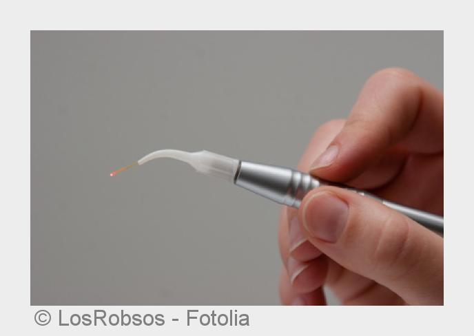 Die Laserbehandlung soll die Sehfähigkeit schnell wieder herstellen. (Bildquelle:©LosRobsos - Fotoli Die Laserbehandlung soll die Sehfähigkeit schnell wieder herstellen. (Bildquelle:©LosRobsos - Fotoli