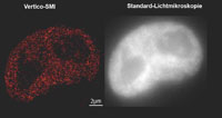 Vertico SMI(li): Die mit dem Quallenprotein GFP sichtbaren gemachten Histone sind einzeln erkennbar
