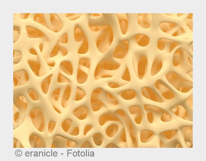 Hormonmangel kann für Osteoporose verantwortlich sein. (Bildquelle:©eranicle - Fotolia)
