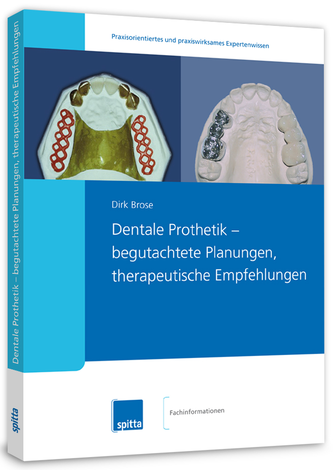 Cover Fachbuch Dentale Prothetik