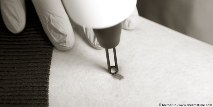 Prager & Partner: Innovative Tattooentfernung – schonend und narbenfrei /© Mkrberlin – www.dreamstim