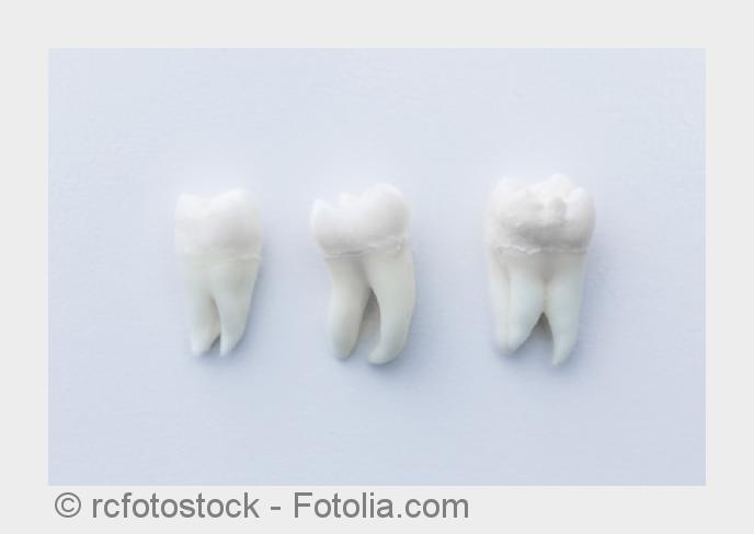 Eine bakterielle Entzündung des Zahnhalteapparetes. (Bildquelle:©rcfotostock - Fotolia.com)