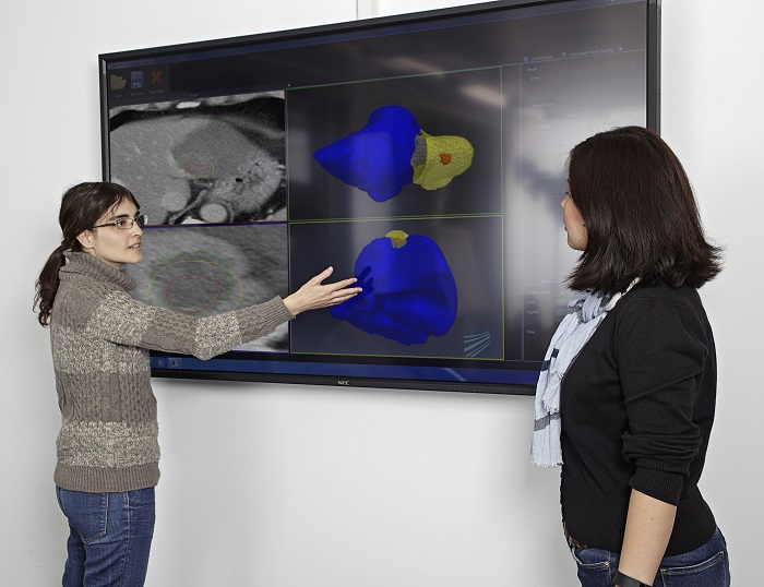 Lebertumor wirklich weg? Ein Fraunhofer IGD Verfahren beantwortet dies nun bis zu 55 % präziser. Lebertumor wirklich weg? Ein Fraunhofer IGD Verfahren beantwortet dies nun bis zu 55 % präziser.