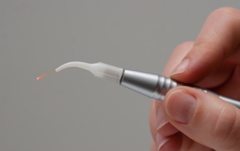 Laserbehandlung bei verschiedenen Augenproblemen. (Bildquelle:©LosRobsos - Fotolia)